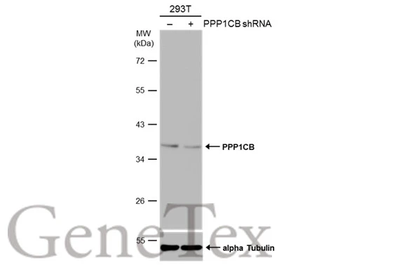 Non-transfected (–) and transfected (+) 293T whole cell extracts (30 μg) were separated by 10% SDS-PAGE, and the membrane was blotted with PPP1CB antibody (GTX105295) diluted at 1:1000. The HRP-conjugated anti-rabbit IgG antibody (GTX213110-01) was used to detect the primary antibody.