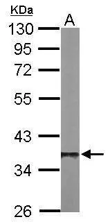 Sample (50 μg of whole cell lysate) A: Mouse brain 10% SDS PAGE GTX105295 diluted at 1:1000 The HRP-conjugated anti-rabbit IgG antibody (GTX213110-01) was used to detect the primary antibody.