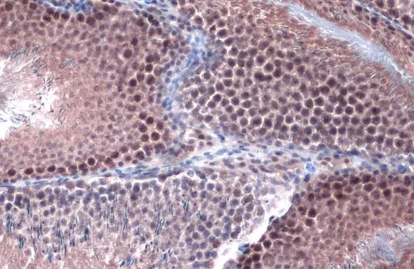 PPP1CB antibody detects PPP1CB protein at cytoplasm and nucleus by immunohistochemical analysis. Sample: Paraffin-embedded rat testis. PPP1CB stained by PPP1CB antibody (GTX105295) diluted at 1:3000. Antigen Retrieval: Citrate buffer, pH 6.0, 15 min