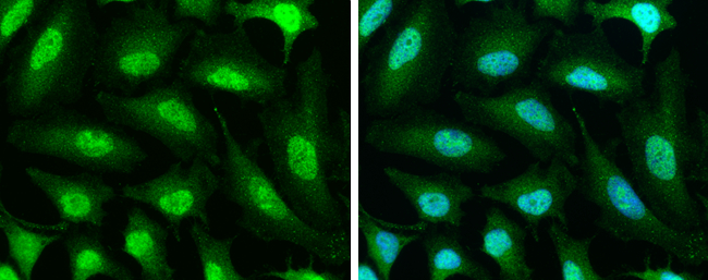 PPP1CB antibody detects PPP1CB protein at cytoplasm and nucleus by immunofluorescent analysis. Sample: HeLa cells were fixed in 4% paraformaldehyde at RT for 15 min. Green: PPP1CB stained by PPP1CB antibody (GTX105295) diluted at 1:500. Blue: Hoechst 33342 staining.