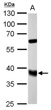 FDPS antibody detects FDPS protein by western blot analysis. A. 50 μg rat liver lysate/extract 10% SDS-PAGE FDPS antibody (GTX105301) dilution: 1:5000 The HRP-conjugated anti-rabbit IgG antibody (GTX213110-01) was used to detect the primary antibody.