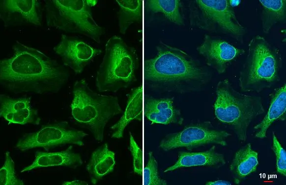 FDPS antibody [N1C3] detects FDPS protein at cytoplasm by immunofluorescent analysis. Sample: HeLa cells were fixed in ice-cold MeOH for 5 min. Green: FDPS stained by FDPS antibody [N1C3] (GTX105301) diluted at 1:500.