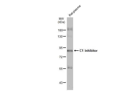 Rat plasma (50 μg) was separated by 7.5% SDS-PAGE, and the membrane was blotted with C1 inhibitor antibody [N1C3] (GTX105316) diluted at 1:1000. The HRP-conjugated anti-rabbit IgG antibody (GTX213110-01) was used to detect the primary antibody.
