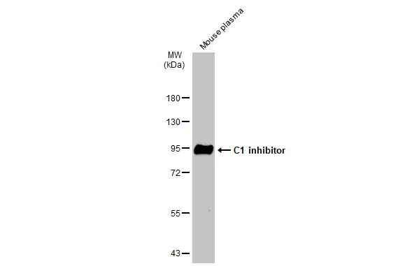 Mouse plasma (50 μg) was separated by 7.5% SDS-PAGE, and the membrane was blotted with C1 inhibitor antibody [N1C3] (GTX105316) diluted at 1:3000. The HRP-conjugated anti-rabbit IgG antibody (GTX213110-01) was used to detect the primary antibody.