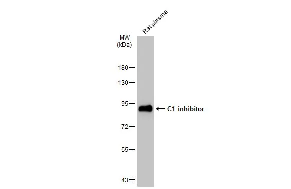 Rat plasma (50 μg) was separated by 7.5% SDS-PAGE, and the membrane was blotted with C1 inhibitor antibody [N1C3] (GTX105316) diluted at 1:3000. The HRP-conjugated anti-rabbit IgG antibody (GTX213110-01) was used to detect the primary antibody.