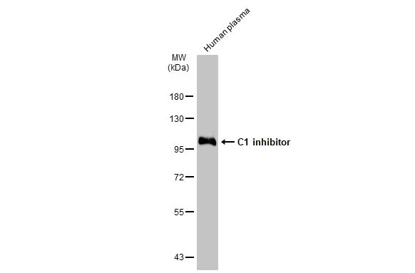 Human plasma (30 μg) was separated by 7.5% SDS-PAGE, and the membrane was blotted with C1 inhibitor antibody [N1C3] (GTX105316) diluted at 1:15000. The HRP-conjugated anti-rabbit IgG antibody (GTX213110-01) was used to detect the primary antibody.