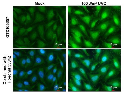 XPD antibody [N2C2], Internal detects XPD protein at cytoplasm and nucleus by immunofluorescent analysis. Sample: Mock and treated HeLa cells were fixed in 4% paraformaldehyde at RT for 15 min. Green: XPD stained by XPD antibody [N2C2], Internal (GTX105357) diluted at 1:500. Blue: Hoechst 33342 staining. Scale bar= 10 μm.