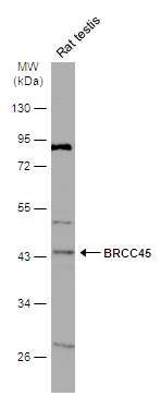 Rat tissue extract (50 μg) was separated by 10% SDS-PAGE, and the membrane was blotted with BRCC45 antibody (GTX105364) diluted at 1:1000. The HRP-conjugated anti-rabbit IgG antibody (GTX213110-01) was used to detect the primary antibody.