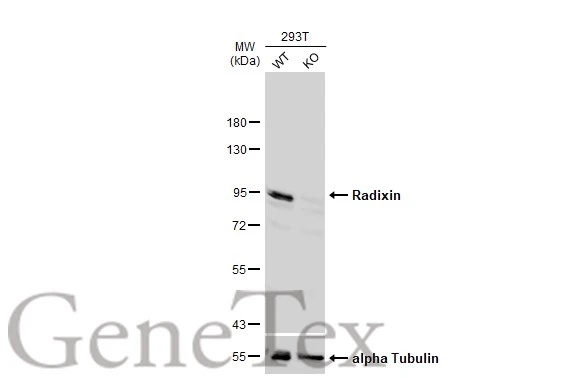 Wild-type (WT) and Radixin knockout (KO) 293T cell extracts (30 μg) were separated by 7.5% SDS-PAGE, and the membrane was blotted with Radixin antibody (GTX105408) diluted at 1:1000. The HRP-conjugated anti-rabbit IgG antibody (GTX213110-01) was used to detect the primary antibody. Wild-type (WT) and Radixin knockout (KO) 293T cell extracts (30 μg) were separated by 7.5% SDS-PAGE, and the membrane was blotted with Radixin antibody (GTX105408) diluted at 1:1000. The HRP-conjugated anti-rabbit IgG antibody (GTX213110-01) was used to detect the primary antibody.