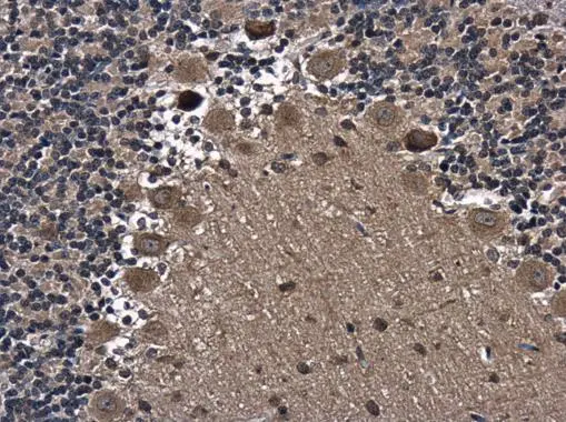 axin 2 antibody [N2C2], Internal detects axin 2 protein at cytoplasm in rat brain by immunohistochemical analysis. Sample: Paraffin-embedded rat brain. axin 2 antibody [N2C2], Internal (GTX105442) diluted at 1:500. 
 Antigen Retrieval: Citrate buffer, pH 6.0, 15 min