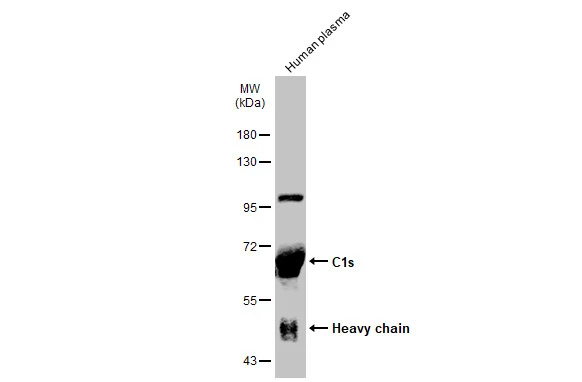 Human plasma (30 μg) was separated by 7.5% SDS-PAGE, and the membrane was blotted with C1s antibody (GTX105464) diluted at 1:1000. The HRP-conjugated anti-rabbit IgG antibody (GTX213110-01) was used to detect the primary antibody.