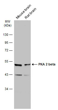 Various tissue extracts (50 μg) were separated by 10% SDS-PAGE, and the membrane was blotted with PKA 2 beta antibody (GTX105558) diluted at 1:1000. The HRP-conjugated anti-rabbit IgG antibody (GTX213110-01) was used to detect the primary antibody.