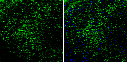 PKA 2 beta antibody detects PKA 2 beta protein by immunohistochemical analysis. Samples: Frozen Sectioned adult mouse hippocampus. Green: PKA 2 beta protein stained by PKA 2 beta antibody (GTX105558) diluted at 1:250. Blue: Fluoroshield with DAPI (GTX30920). 
 Antigen Retrieval: Citrate buffer, pH 6.0, 10 min