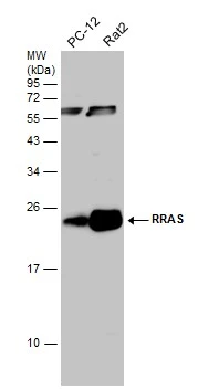 Various whole cell extracts (30 μg) were separated by 12% SDS-PAGE, and the membrane was blotted with RRAS antibody [N1C3] (GTX105575) diluted at 1:500.