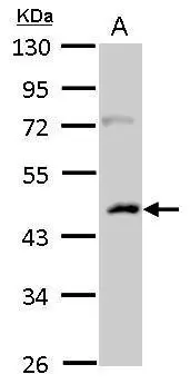 Casein Kinase 1 alpha 1L antibody detects CSNK1A1L protein by Western blot analysis. A. 50 μg rat thymus lysate/extract 10 % SDS-PAGE Casein Kinase 1 alpha 1L antibody (GTX105584) dilution: 1:500