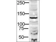 Western blot using GeneTex Affinity Purified anti-DIAPH2 antibody (GTX10562) shows detection of a 132-kDa band corresponding to DIAPH2 in a lysate prepared from human derived HEK293 cells.