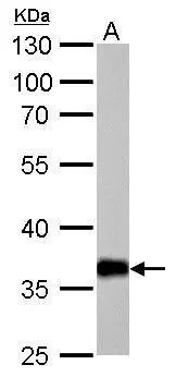 AKR1C1 antibody detects AKR1C1 protein by western blot analysis. A. 50 μg mouse liver lysate/extract 10% SDS-PAGE AKR1C1 antibody (GTX105620) dilution: 1:1000 The HRP-conjugated anti-rabbit IgG antibody (GTX213110-01) was used to detect the primary antibody.