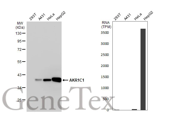 Various whole cell extracts (30 μg) were separated by 10% SDS-PAGE, and the membrane was blotted with AKR1C1 antibody (GTX105620) diluted at 1:1000. The HRP-conjugated anti-rabbit IgG antibody (GTX213110-01) was used to detect the primary antibody. Corresponding RNA expression data for the same cell lines are based on Human Protein Atlas program.