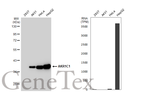 Anti-AKR1C1 antibody (GTX105620) | GeneTex