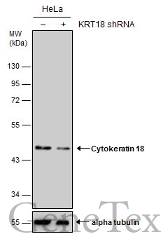 Non-transfected (–) and transfected (+) HeLa whole cell extracts (15 μg) were separated by 10% SDS-PAGE, and the membrane was blotted with Cytokeratin 18 antibody [N2C2], Internal (GTX105624) diluted at 1:2000.
