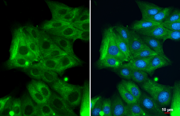 Cytokeratin 18 antibody detects Cytokeratin 18 protein at cytoplasm by immunofluorescent analysis. Sample: MDCK cells were fixed in 4% paraformaldehyde at RT for 15 min. Green: Cytokeratin 18 stained by Cytokeratin 18 antibody (GTX105624) diluted at 1:500.