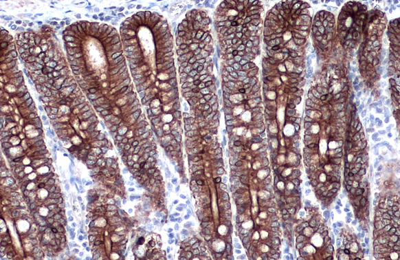 Cytokeratin 18 antibody detects Cytokeratin 18 protein at cell membrane and cytoplasm by immunohistochemical analysis. Sample: Paraffin-embedded dog intestine. Cytokeratin 18 stained by Cytokeratin 18 antibody (GTX105624) diluted at 1:500. Antigen Retrieval: Citrate buffer, pH 6.0, 15 min
