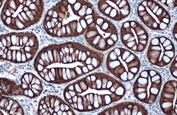 Cytokeratin 18 antibody detects Cytokeratin 18 protein at cell membrane and cytoplasm by immunohistochemical analysis. Sample: Paraffin-embedded dog colon. Cytokeratin 18 stained by Cytokeratin 18 antibody (GTX105624) diluted at 1:500. Antigen Retrieval: Citrate buffer, pH 6.0, 15 min
