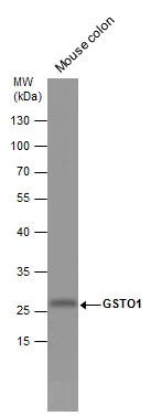 Mouse tissue extract (50 μg) was separated by 12% SDS-PAGE, and the membrane was blotted with GSTO1 antibody [N1C3] (GTX105655) diluted at 1:1000. The HRP-conjugated anti-rabbit IgG antibody (GTX213110-01) was used to detect the primary antibody.
