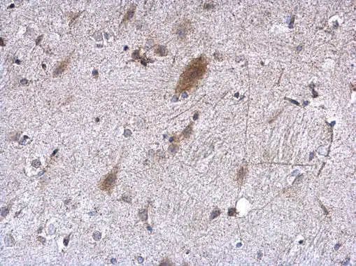 EEF1E1 antibody [N1C3] detects EEF1E1 protein at cytoplasm on mouse fore brain by immunohistochemical analysis. Sample: Paraffin-embedded mouse fore brain. EEF1E1 antibody [N1C3] (GTX105658) diluted at 1:500. 
 Antigen Retrieval: Trilogy? (EDTA based, pH 8.0) buffer, 15min