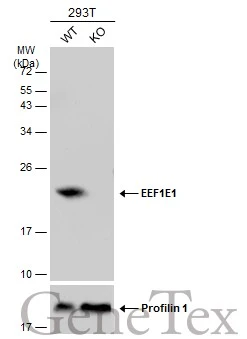 Wild-type (WT) and EEF1E1 knockout (KO) 293T cell extracts (30 μg) were separated by 12% SDS-PAGE, and the membrane was blotted with EEF1E1 antibody [N1C3] (GTX105658) diluted at 1:500. The HRP-conjugated anti-rabbit IgG antibody (GTX213110-01) was used to detect the primary antibody.