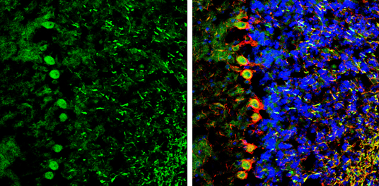 NCKAP1 antibody [C1C2], Internal detects NCKAP1 protein by immunohistochemical analysis. Sample: Frozen-sectioned mouse cerebellum. Green: NCKAP1 stained by NCKAP1 antibody [C1C2], Internal (GTX105682) diluted at 1:250. Red: NF-H, stained by NF-H antibody [GT114] (GTX634289) diluted at 1:500. Blue: Fluoroshield with DAPI (GTX30920).
