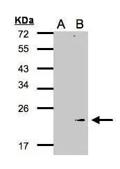 Western Blot analysis of GPX7 expression in transfected 293T cell line by GPX7 polyclonal antibody.