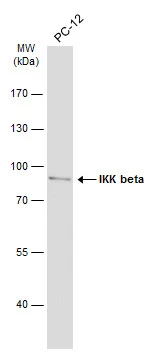 Whole cell extract (30 μg) was separated by 7.5% SDS-PAGE, and the membrane was blotted with IKK beta antibody (GTX105690) diluted at 1:1000. The HRP-conjugated anti-rabbit IgG antibody (GTX213110-01) was used to detect the primary antibody.