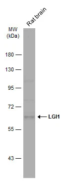 Rat tissue extract (50 μg) was separated by 7.5% SDS-PAGE, and the membrane was blotted with LGI1 antibody [N2C2], Internal (GTX105700) diluted at 1:1000. The HRP-conjugated anti-rabbit IgG antibody (GTX213110-01) was used to detect the primary antibody.