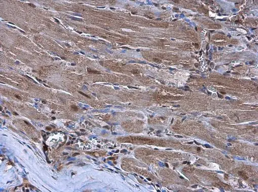 Nkx2.5 antibody detects Nkx2.5 protein at cytoplasm and nucleus by immunohistochemical analysis.Sample: Paraffin-embedded rat heart.
Nkx2.5 stained by Nkx2.5 antibody (GTX105711) diluted at 1:500. 
Antigen Retrieval: Citrate buffer, pH 6.0, 15 min