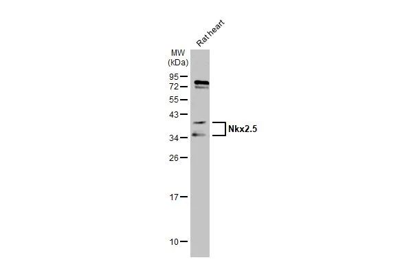 Rat tissue extract (50 μg) was separated by 12% SDS-PAGE, and the membrane was blotted with Nkx2.5 antibody (GTX105711) diluted at 1:1000. The HRP-conjugated anti-rabbit IgG antibody (GTX213110-01) was used to detect the primary antibody.
