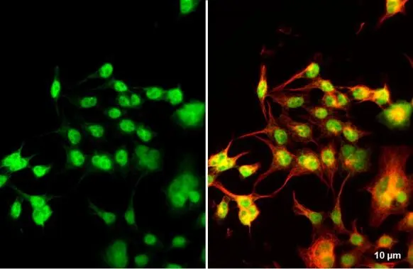 Nkx2.5 antibody detects Nkx2.5 protein at nucleus by immunofluorescent analysis. Sample: 293T cells were fixed in 4% paraformaldehyde at RT for 15 min. Green: Nkx2.5 stained by Nkx2.5 antibody (GTX105711) diluted at 1:500. Red: alpha Tubulin, a cytoskeleton marker, stained by alpha Tubulin antibody [GT114] (GTX628802) diluted at 1:1000.