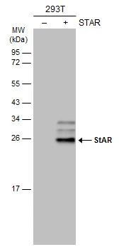 Non-transfected (–) and transfected (+) 293T whole cell extracts (30 μg) were separated by 12% SDS-PAGE, and the membrane was blotted with StAR antibody (GTX105716) diluted at 1:5000. The HRP-conjugated anti-rabbit IgG antibody (GTX213110-01) was used to detect the primary antibody.