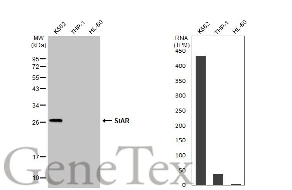 Various whole cell extracts (30 μg) were separated by 12% SDS-PAGE, and the membrane was blotted with StAR antibody (GTX105716) diluted at 1:1000. The HRP-conjugated anti-rabbit IgG antibody (GTX213110-01) was used to detect the primary antibody. Corresponding RNA expression data for the same cell lines are based on Human Protein Atlas program.