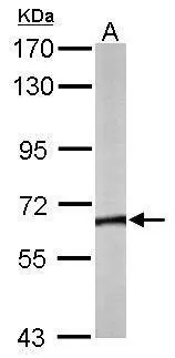 Sample (50 ug of whole cell lysate) A: Mouse brain 7.5% SDS PAGE GTX105725 diluted at 1:5000 Sample (50 ug of whole cell lysate) A: Mouse brain 7.5% SDS PAGE GTX105725 diluted at 1:5000