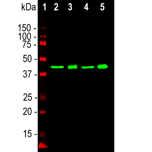 WB analysis of various samples using GTX10574 TDP43 antibody [3H8]. Green : Primary antibody Lane 1 : protein standard (red) Lane 2 : rat brain tissue lysate Lane 3 : nuclear extract from rat brain Lane 4 : mouse brain tissue lysate Lane 5 : nuclear extract from mouse brain Dilution : 1:2000