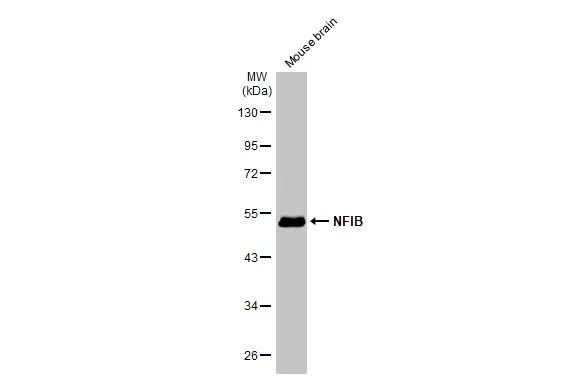 Mouse tissue extract (50 μg) was separated by 10% SDS-PAGE, and the membrane was blotted with NFIB antibody [N1C2] (GTX105749) diluted at 1:3000. The HRP-conjugated anti-rabbit IgG antibody (GTX213110-01) was used to detect the primary antibody.
