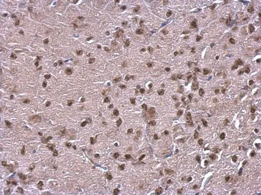 NFIB antibody [N1C2] detects NFIB protein at nucleus on mouse fore brain by immunohistochemical analysis. Sample: Paraffin-embedded mouse fore brain. NFIB antibody [N1C2] (GTX105749) dilution: 1:500. 
 Antigen Retrieval: Trilogy? (EDTA based, pH 8.0) buffer, 15min