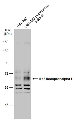 U87-MG whole cell and membrane extracts (30 μg) were separated by 10% SDS-PAGE, and the membrane was blotted with IL13 Receptor alpha 1 antibody (GTX105788) diluted at 1:500. The HRP-conjugated anti-rabbit IgG antibody (GTX213110-01) was used to detect the primary antibody. U87-MG whole cell and membrane extracts (30 μg) were separated by 10% SDS-PAGE, and the membrane was blotted with IL13 Receptor alpha 1 antibody (GTX105788) diluted at 1:500. The HRP-conjugated anti-rabbit IgG antibody (GTX213110-01) was used to detect the primary antibody.