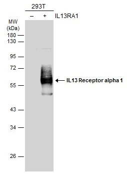 Non-transfected (–) and transfected (+) 293T whole cell extracts (30 μg) were separated by 10% SDS-PAGE, and the membrane was blotted with IL13 Receptor alpha 1 antibody (GTX105788) diluted at 1:20000. The HRP-conjugated anti-rabbit IgG antibody (GTX213110-01) was used to detect the primary antibody. Non-transfected (–) and transfected (+) 293T whole cell extracts (30 μg) were separated by 10% SDS-PAGE, and the membrane was blotted with IL13 Receptor alpha 1 antibody (GTX105788) diluted at 1:20000. The HRP-conjugated anti-rabbit IgG antibody (GTX213110-01) was used to detect the primary antibody.