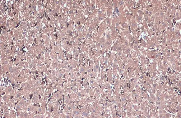 IL13 Receptor alpha 1 antibody detects IL13 Receptor alpha 1 protein at cytoplasm by immunohistochemical analysis. Sample: Paraffin-embedded rat liver. IL13 Receptor alpha 1 stained by IL13 Receptor alpha 1 antibody (GTX105788) diluted at 1:500. Antigen Retrieval: Citrate buffer, pH 6.0, 15 min IL13 Receptor alpha 1 antibody detects IL13 Receptor alpha 1 protein at cytoplasm by immunohistochemical analysis. Sample: Paraffin-embedded rat liver. IL13 Receptor alpha 1 stained by IL13 Receptor alpha 1 antibody (GTX105788) diluted at 1:500. Antigen Retrieval: Citrate buffer, pH 6.0, 15 min