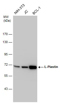 Various whole cell extracts (30 μg) were separated by 7.5% SDS-PAGE, and the membrane was blotted with L-Plastin antibody (GTX105789) diluted at 1:10000.
