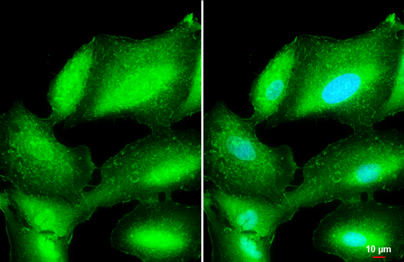 L-Plastin antibody detects L-Plastin protein by immunofluorescent analysis. Sample: A549 cells were fixed in ice-cold MeOH for 5 min. Green: L-Plastin stained by L-Plastin antibody (GTX105789) diluted at 1:500. Blue: Hoechst 33342 staining. Scale bar= 10 μm.