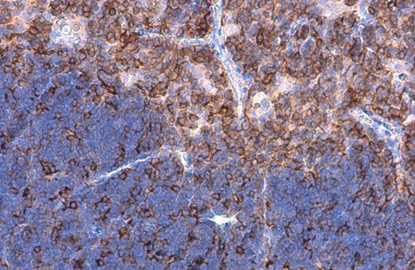 L-Plastin antibody detects L-Plastin protein at cell membrane by immunohistochemical analysis. Sample: Paraffin-embedded mouse thymus gland. L-Plastin stained by L-Plastin antibody (GTX105789) diluted at 1:500. Antigen Retrieval: Citrate buffer, pH 6.0, 15 min