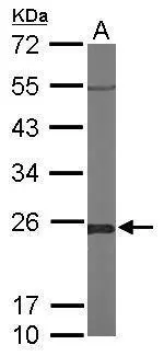 Sample (50 μg of whole cell lysate) A: Mouse brain 12% SDS PAGE GTX105792 diluted at 1:1000 The HRP-conjugated anti-rabbit IgG antibody (GTX213110-01) was used to detect the primary antibody.